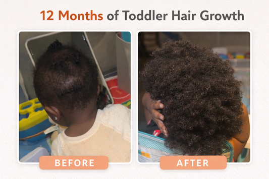 A 12 Month Toddler Hair Growth Journey: Gentle Care for Delicate Curls