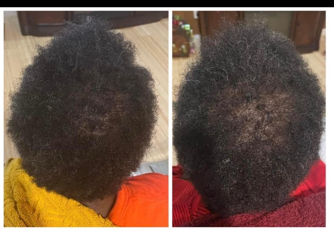 Rooted Hair Growth Oil